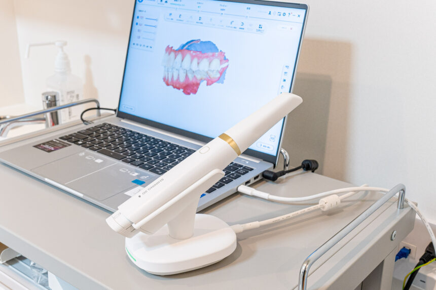 口腔内スキャナー