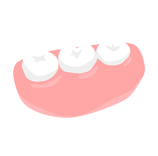 コンフォート（部分入れ歯）