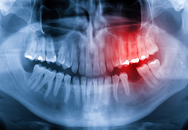 顎顔面外傷（がくがんめんがいしょう）