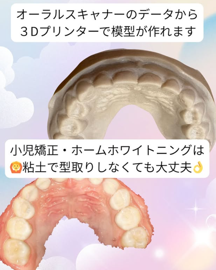 お口の型取りが苦手な方へ…朗報です📣