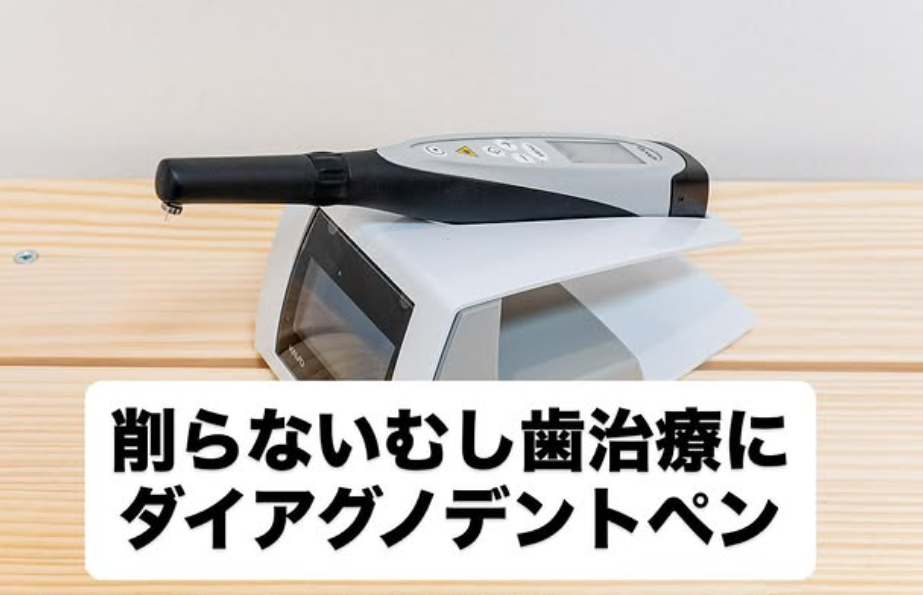✨ダイアグノデントペン導入しました！✨