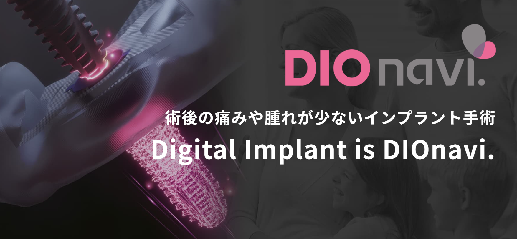【インプラント手術をより安全に。DIO navi（ディオナビ）導入しています】