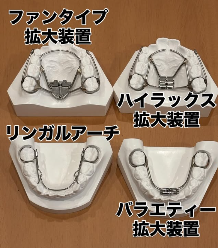 【顎顔面矯正で使用する拡大装置】